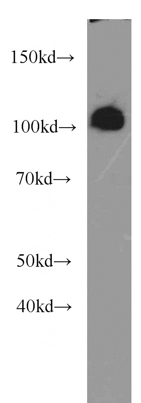 COLO 320 cells were subjected to SDS PAGE followed by western blot with Catalog No:113334(OGFR antibody) at dilution of 1:1000