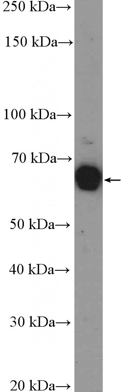 A431 cells were subjected to SDS PAGE followed by western blot with Catalog No:115266(SHC1 Antibody) at dilution of 1:1000
