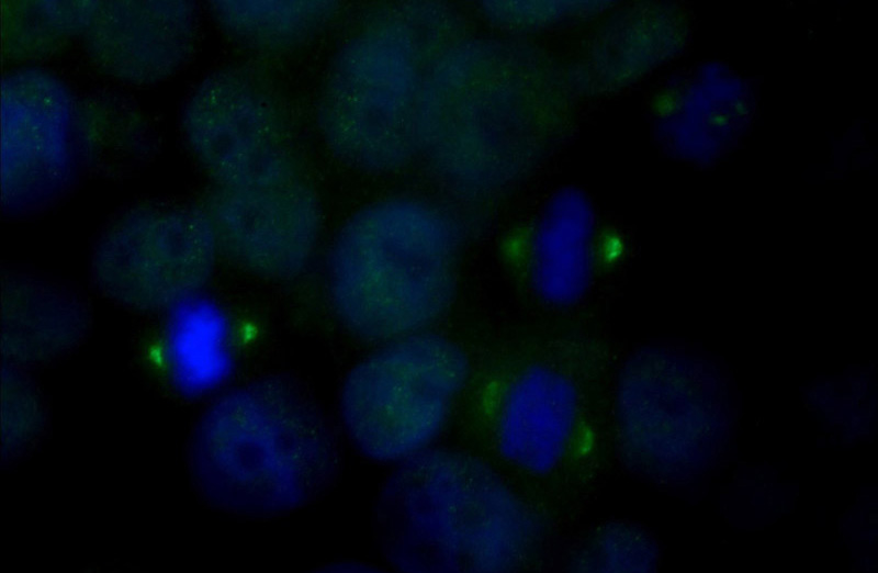 Immunofluorescent analysis of MCF-7 cells using Catalog No:112698(MMP13 Antibody) at dilution of 1:25 and Alexa Fluor 488-congugated AffiniPure Goat Anti-Rabbit IgG(H+L)