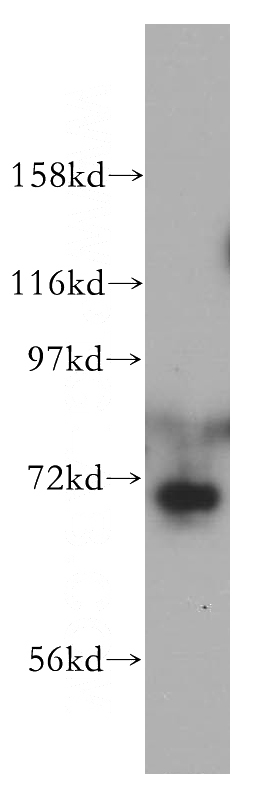 HeLa cells were subjected to SDS PAGE followed by western blot with Catalog No:109618(CSTF2T antibody) at dilution of 1:500