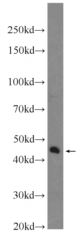 Jurkat cells were subjected to SDS PAGE followed by western blot with Catalog No:116989(XKR6 Antibody) at dilution of 1:1000