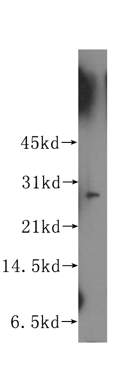 human kidney tissue were subjected to SDS PAGE followed by western blot with Catalog No:108141(APIP antibody) at dilution of 1:500