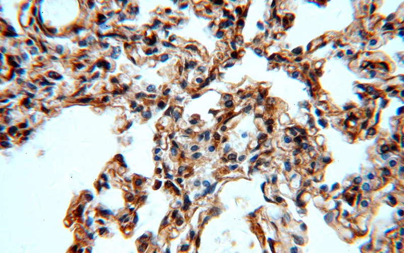 Immunohistochemical of paraffin-embedded human lung using Catalog No:112494(MAT2B antibody) at dilution of 1:100 (under 40x lens)