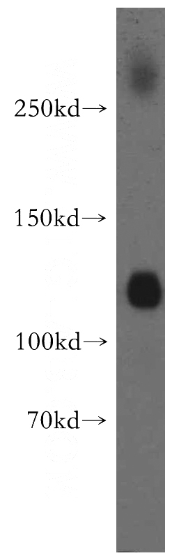 human brain tissue were subjected to SDS PAGE followed by western blot with Catalog No:115300(SLC12A5-Specific antibody) at dilution of 1:300