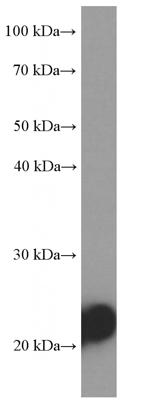 human skeletal muscle tissue were subjected to SDS PAGE followed by western blot with Catalog No:107315(MYL3 Antibody) at dilution of 1:20000
