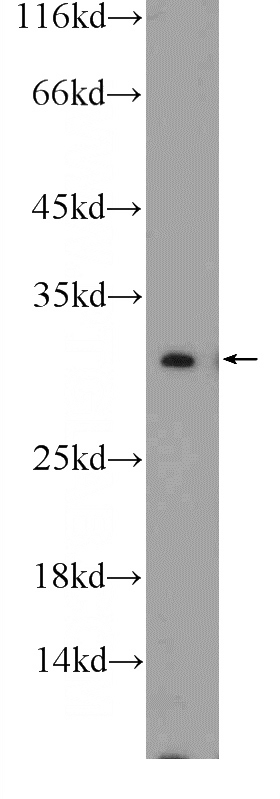 mouse ovary tissue were subjected to SDS PAGE followed by western blot with Catalog No:109501(COX7C Antibody) at dilution of 1:1000