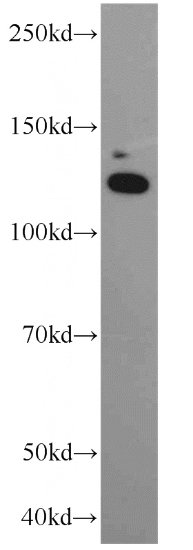 A431 cells were subjected to SDS PAGE followed by western blot with Catalog No:112888(CA15-3,MUC1 antibody) at dilution of 1:1500