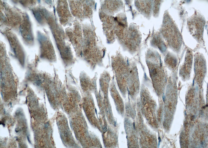 Immunohistochemistry of paraffin-embedded human heart tissue slide using Catalog No:108660(C14orf159 Antibody) at dilution of 1:50 (under 40x lens)