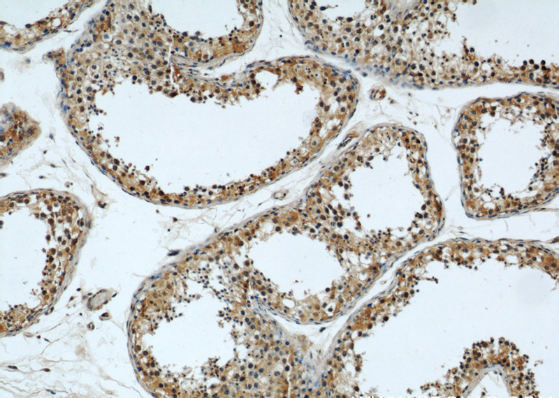 Immunohistochemical of paraffin-embedded human testis using Catalog No:110360(ERI1 antibody) at dilution of 1:50 (under 10x lens)