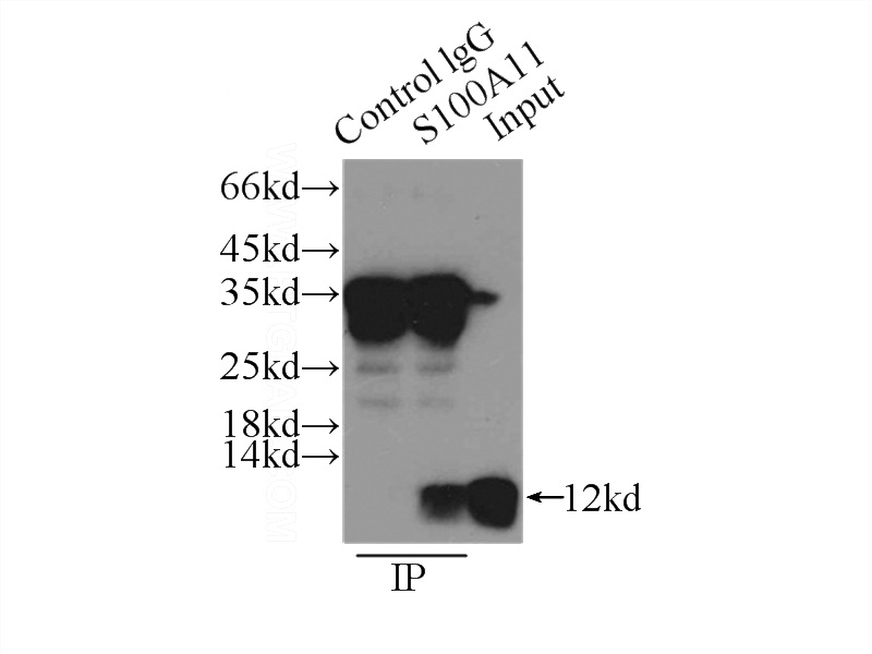 IP Result of anti-S100A11 (IP:Catalog No:114955, 3ug; Detection:Catalog No:114955 1:1000) with PC-3 cells lysate 1000ug.