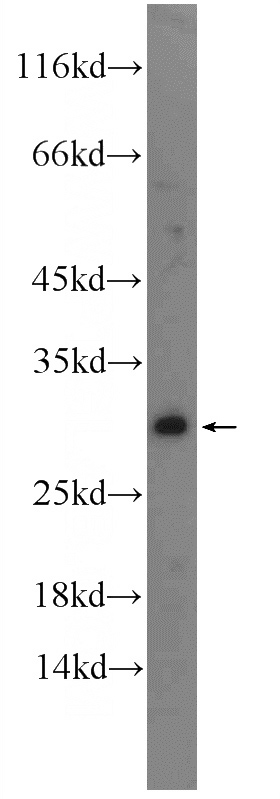 HT-1080 cells were subjected to SDS PAGE followed by western blot with Catalog No:110447(FADD Antibody) at dilution of 1:300