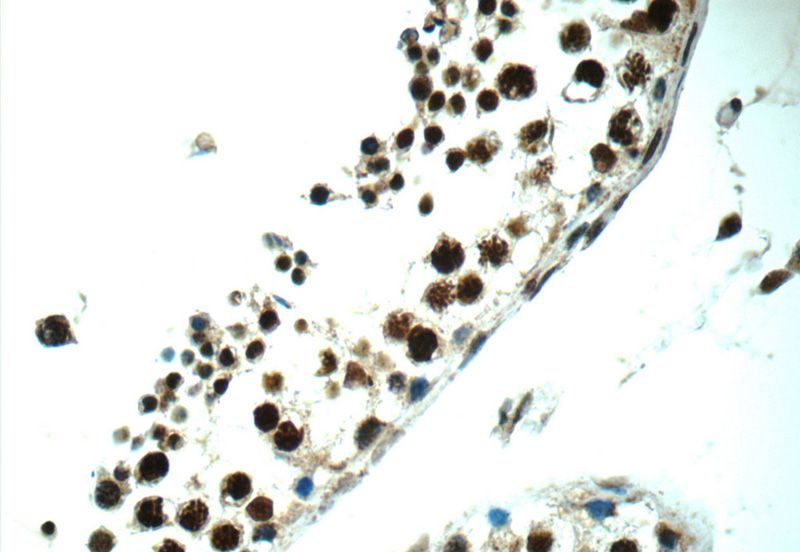 Immunohistochemistry of paraffin-embedded human testis tissue slide using Catalog No:107885(ALS2CR8 Antibody) at dilution of 1:50 (under 40x lens)