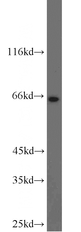 HeLa cells were subjected to SDS PAGE followed by western blot with Catalog No:110103(DNAJC11 antibody) at dilution of 1:1000