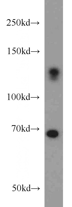 mouse brain tissue were subjected to SDS PAGE followed by western blot with Catalog No:116926(ZC3H4 antibody) at dilution of 1:500