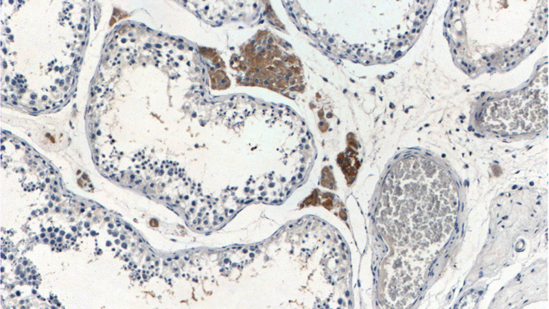 Immunohistochemistry of paraffin-embedded human testis tissue slide using Catalog No:115579(SPocK2 Antibody) at dilution of 1:200 (under 10x lens).