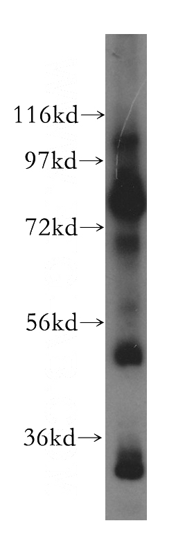 mouse brain tissue were subjected to SDS PAGE followed by western blot with Catalog No:110502(SEC10 antibody) at dilution of 1:400