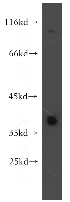 human brain tissue were subjected to SDS PAGE followed by western blot with Catalog No:116363(TSPAN5 antibody) at dilution of 1:300