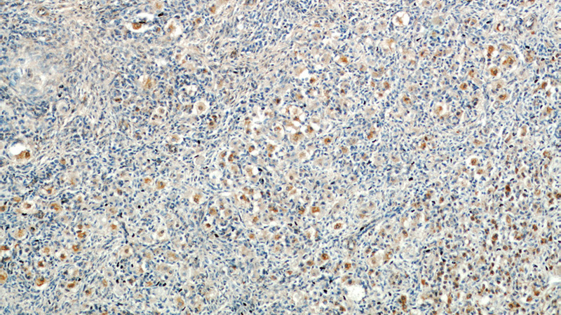 Immunohistochemical of paraffin-embedded human ovary using Catalog No:110295(ECM2 antibody) at dilution of 1:50 (under 10x lens)
