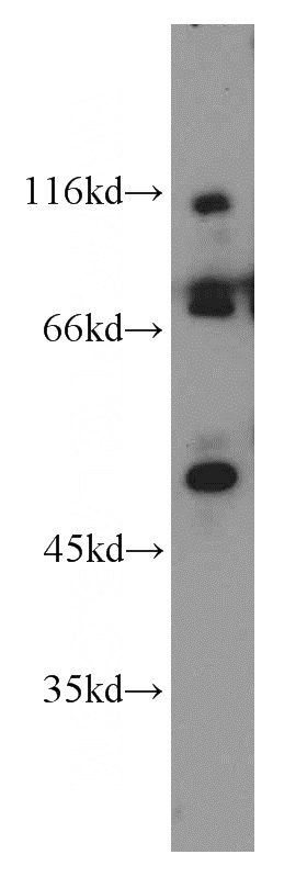 mouse brain tissue were subjected to SDS PAGE followed by western blot with Catalog No:110530(FASTKD2 antibody) at dilution of 1:1000