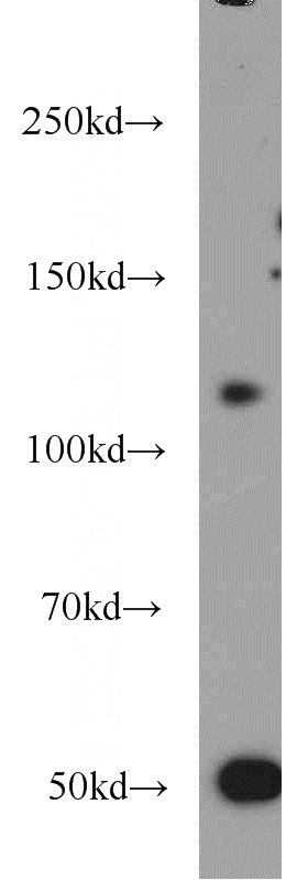 mouse brain tissue were subjected to SDS PAGE followed by western blot with Catalog No:114363(PTK2B antibody) at dilution of 1:1000