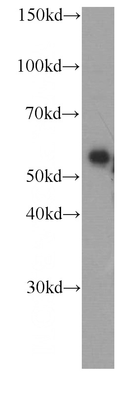 HepG2 cells were subjected to SDS PAGE followed by western blot with Catalog No:107206(AHSG antibody) at dilution of 1:5000