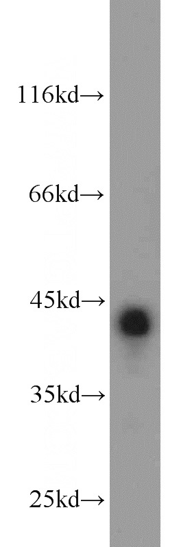 mouse testis tissue were subjected to SDS PAGE followed by western blot with Catalog No:115757(SYCE1 antibody) at dilution of 1:1000