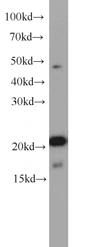 mouse brain tissue were subjected to SDS PAGE followed by western blot with Catalog No:112121(KRAS-2B-speicifc antibody) at dilution of 1:1000