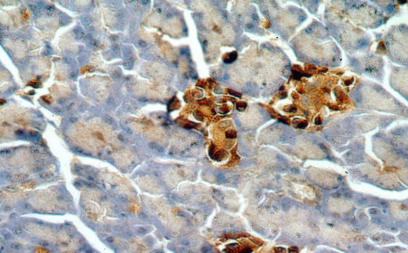 Immunohistochemical of paraffin-embedded human pancreas using Catalog No:115439(SMYD4 antibody) at dilution of 1:50 (under 40x lens)