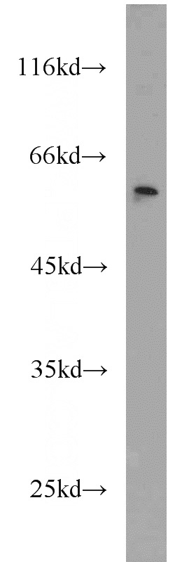 HeLa cells were subjected to SDS PAGE followed by western blot with Catalog No:109616(CSTF1 antibody) at dilution of 1:1000