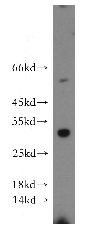 human brain tissue were subjected to SDS PAGE followed by western blot with Catalog No:117150(BIRC8 antibody) at dilution of 1:300