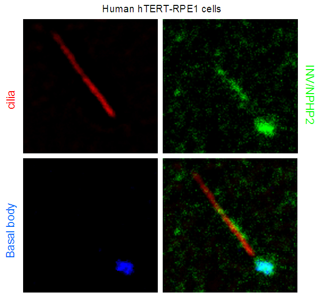 IF result from Dr. Corbit, Kevin. anti-INVS(also named as NPHP2; Catalog No:111814) marks the ‘inversin compartment’ and basal bodies of Human hTERT-RPE1 cells.