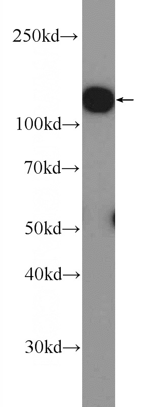 K-562 cells were subjected to SDS PAGE followed by western blot with Catalog No:110018(Drebrin Antibody) at dilution of 1:3000