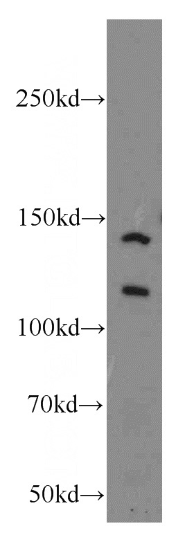 HepG2 cells were subjected to SDS PAGE followed by western blot with Catalog No:113046(NCOR1 antibody) at dilution of 1:300
