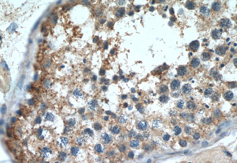 Immunohistochemistry of paraffin-embedded human testis tissue slide using Catalog No:111108(GPR123-Specific Antibody) at dilution of 1:50 (under 40x lens)