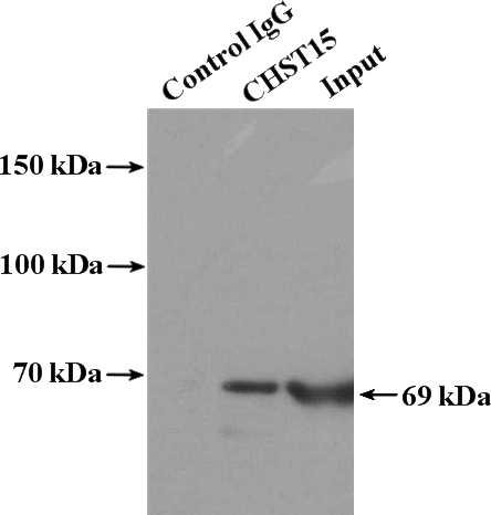 IP Result of anti-CHST15 (IP:Catalog No:109296, 4ug; Detection:Catalog No:109296 1:500) with Raji cells lysate 3200ug.