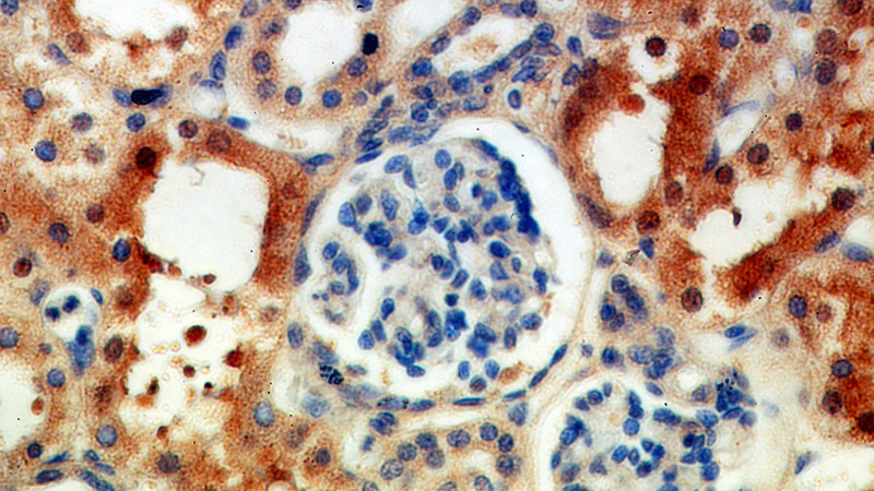 Immunohistochemical of paraffin-embedded human kidney using Catalog No:114293(PSAT1 antibody) at dilution of 1:100 (under 40x lens)