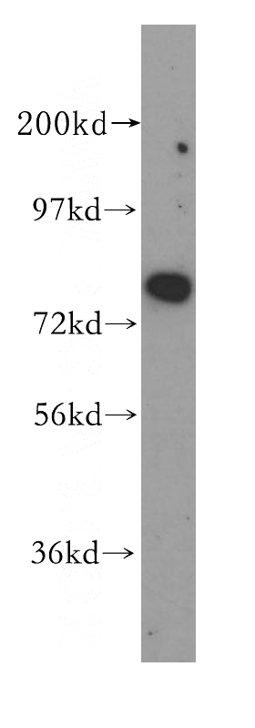 HeLa cells were subjected to SDS PAGE followed by western blot with Catalog No:113032(NCAPH antibody) at dilution of 1:500