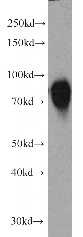 mouse placenta tissue were subjected to SDS PAGE followed by western blot with Catalog No:115892(TBX3 antibody) at dilution of 1:500