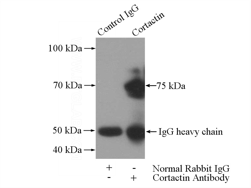 IP Result of anti-Cortactin (IP:Catalog No:109478, 4ug; Detection:Catalog No:109478 1:300) with HEK-293 cells lysate 2000ug.