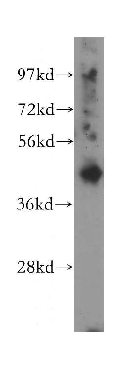 A549 cells were subjected to SDS PAGE followed by western blot with Catalog No:113547(P2RY6 antibody) at dilution of 1:300