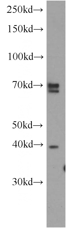 HeLa cells were subjected to SDS PAGE followed by western blot with Catalog No:110365(ERLIN2 antibody) at dilution of 1:500