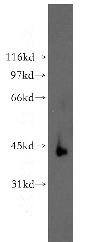 mouse skin tissue were subjected to SDS PAGE followed by western blot with Catalog No:114556(RBMS2 antibody) at dilution of 1:400