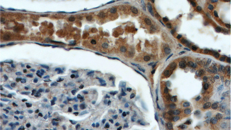 Immunohistochemistry of paraffin-embedded human kidney tissue slide using Catalog No:108083(ANKRD6 Antibody) at dilution of 1:50 (under 40x lens)