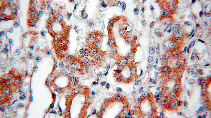 Immunohistochemical of paraffin-embedded human kidney using Catalog No:107908(AFG3L2 antibody) at dilution of 1:50 (under 40x lens)
