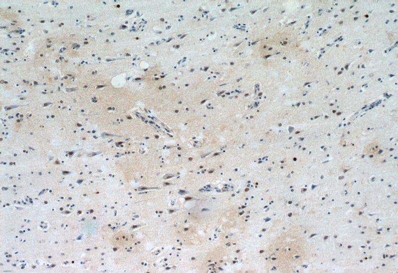Immunohistochemical of paraffin-embedded human brain using Catalog No:115144(SFPQ antibody) at dilution of 1:50 (under 10x lens)