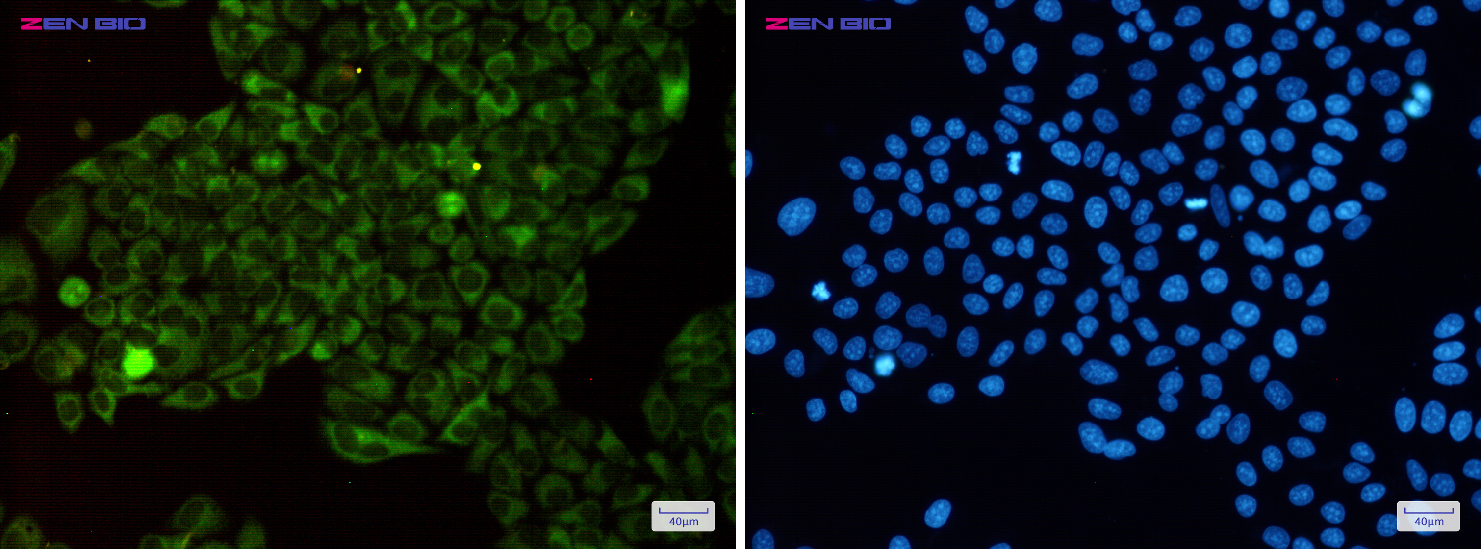 Immunocytochemistry of Methionyl tRNA synthetase(green) in Hela cells using Methionyl tRNA synthetase Rabbit pAb at dilution 1/50, and DAPI(blue)
