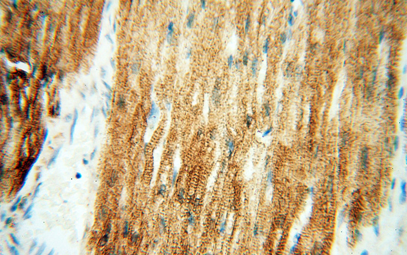 Immunohistochemical of paraffin-embedded human heart using Catalog No:108910(CASQ2 antibody) at dilution of 1:100 (under 40x lens)