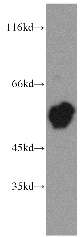 mouse thymus tissue were subjected to SDS PAGE followed by western blot with Catalog No:115255(SKAP55,SKAP1 antibody) at dilution of 1:800