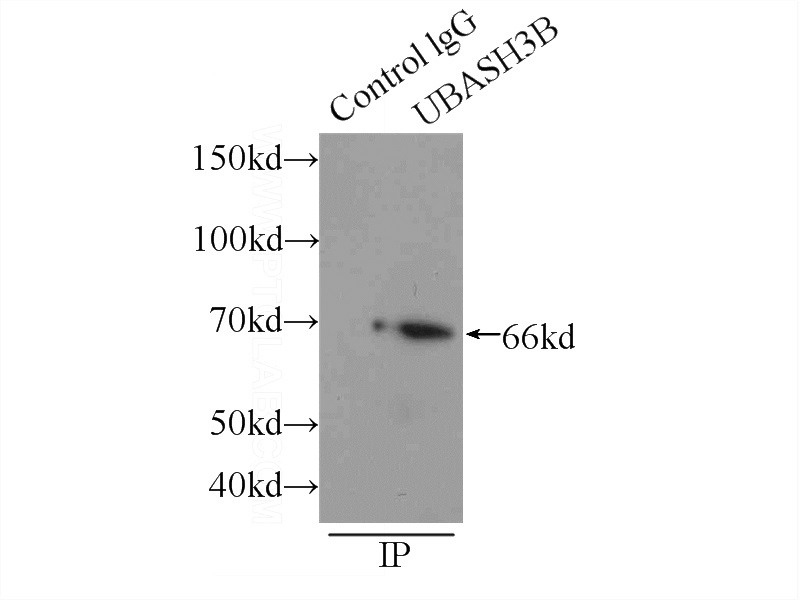 IP Result of anti-UBASH3B (IP:Catalog No:116475, 3ug; Detection:Catalog No:116475 1:300) with mouse kidney tissue lysate 6000ug.