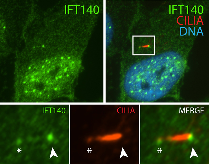IF result (enrichment to the base (arrowhead) and tip (asterix) of cilia) of anti-IFT140 (Catalog No:111664, 1:50) with serum-starved hTERT-RPE1 (PFA fixed) by Dr. Moshe Kim.